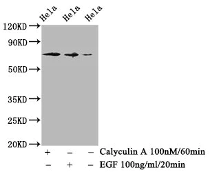 Western blot - Anti-Raf1 (phospho S259) antibody [4C9] (AB314036)
