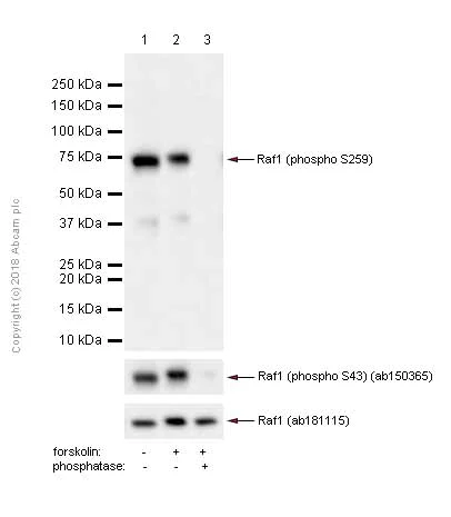 Western blot - Anti-Raf1 (phospho S259) antibody [EPR3433(2)] (AB173539)