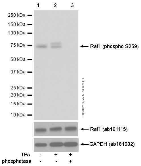 Western blot - Anti-Raf1 (phospho S259) antibody [EPR3433(2)] (AB173539), expandable thumbnail