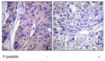 Immunohistochemistry (Formalin/PFA-fixed paraffin-embedded sections) - Anti-Raf1 (phospho S296) antibody (AB60985)