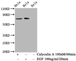 Western blot - Anti-Raf1 (phospho S621) antibody [1C2] (AB314035)