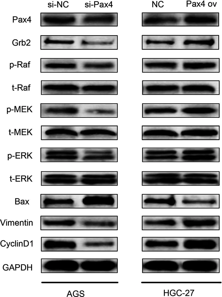 Western blot - Anti-Raf1 (phospho S621) antibody [EPR1521(2)] (AB157201)