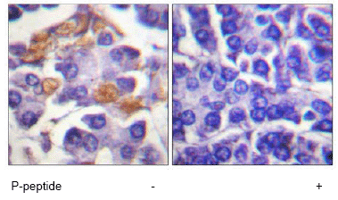 Immunohistochemistry (Formalin/PFA-fixed paraffin-embedded sections) - Anti-Raf1 (phospho Y341) antibody (AB59223)
