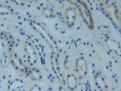 Immunohistochemistry (Formalin/PFA-fixed paraffin-embedded sections) - Anti-Raftlin antibody (AB233438)