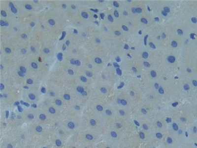 Immunohistochemistry (Formalin/PFA-fixed paraffin-embedded sections) - Anti-Raftlin antibody (AB233438)