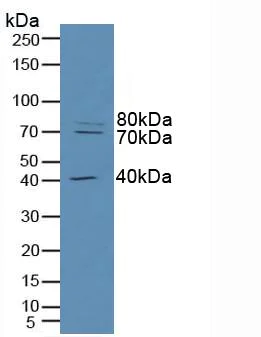 Western blot - Anti-Raftlin antibody (AB233438)