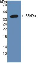 Western blot - Anti-Raftlin antibody (AB233438)