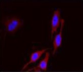 Immunocytochemistry/ Immunofluorescence - Anti-Rag A antibody (AB128196)