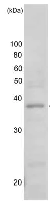 Western blot - Anti-Rag A antibody (AB128196)