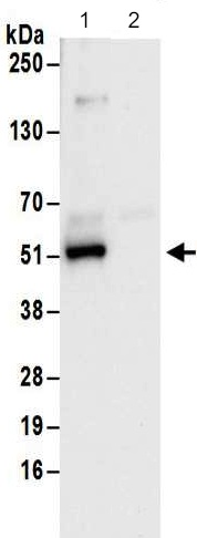 Immunoprecipitation - Anti-Rag D antibody - N-terminal (AB187679)
