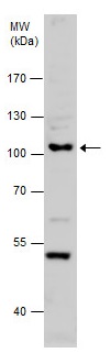 Western blot - Anti-RAG1 antibody - C-terminal (AB229673)