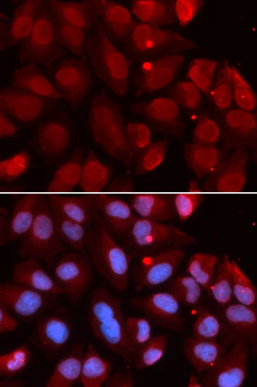 Immunocytochemistry/ Immunofluorescence - Anti-RAG2 antibody (AB189835)