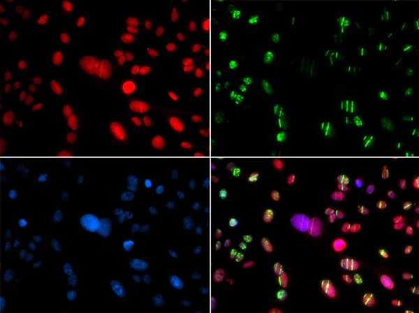Immunocytochemistry/ Immunofluorescence - Anti-RAG2 antibody (AB189835)