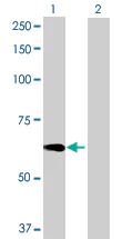 Western blot - Anti-RAG2 antibody (AB72962)