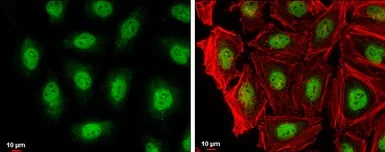 Immunocytochemistry/ Immunofluorescence - Anti-RAG2 antibody (AB95955)
