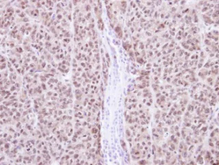 Immunohistochemistry (Formalin/PFA-fixed paraffin-embedded sections) - Anti-RAG2 antibody (AB95955)