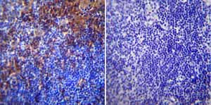 Immunohistochemistry (Formalin/PFA-fixed paraffin-embedded sections) - Anti-RAGE antibody (AB3611)