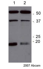 Western blot - Anti-RAGE antibody (AB37647)