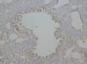 Immunohistochemistry (Formalin/PFA-fixed paraffin-embedded sections) - Anti-RAGE antibody (AB65965)
