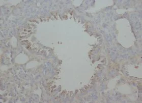 Immunohistochemistry (Formalin/PFA-fixed paraffin-embedded sections) - Anti-RAGE antibody (AB65965)