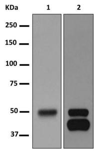 Western blot - Anti-RAGE antibody [EPR12205] - BSA and Azide free (AB250494)
