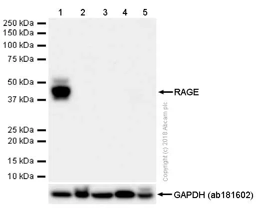 Western blot - Anti-RAGE antibody [EPR16849-75] (AB181293)