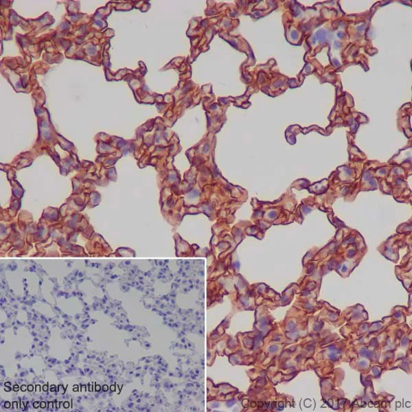 Immunohistochemistry (Formalin/PFA-fixed paraffin-embedded sections) - Anti-RAGE antibody [EPR21171] (AB216329)