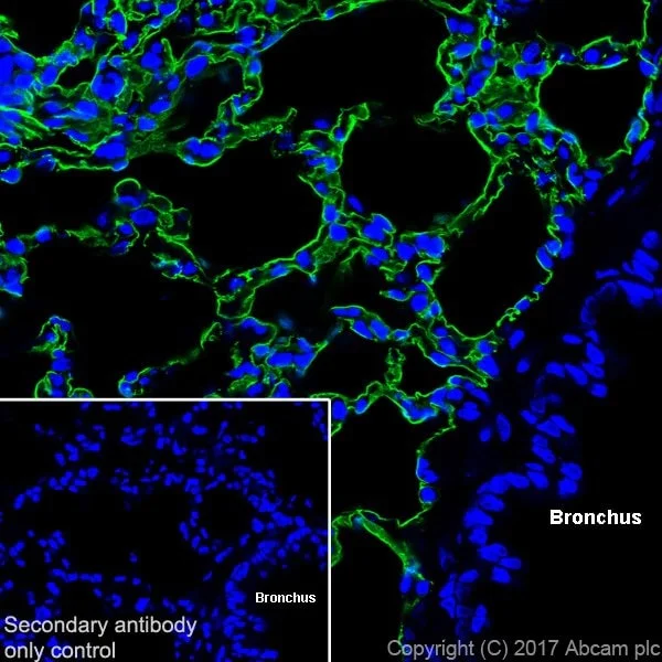 Immunohistochemistry (Frozen sections) - Anti-RAGE antibody [EPR21171] (AB216329)