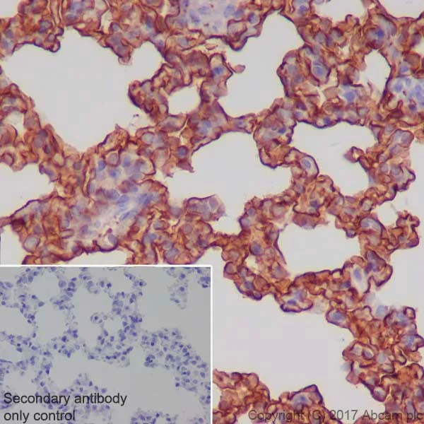 Immunohistochemistry (Formalin/PFA-fixed paraffin-embedded sections) - Anti-RAGE antibody [EPR21171] - BSA and Azide free (AB228861)