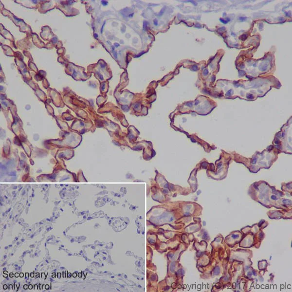 Immunohistochemistry (Formalin/PFA-fixed paraffin-embedded sections) - Anti-RAGE antibody [EPR21171] - BSA and Azide free (AB228861)