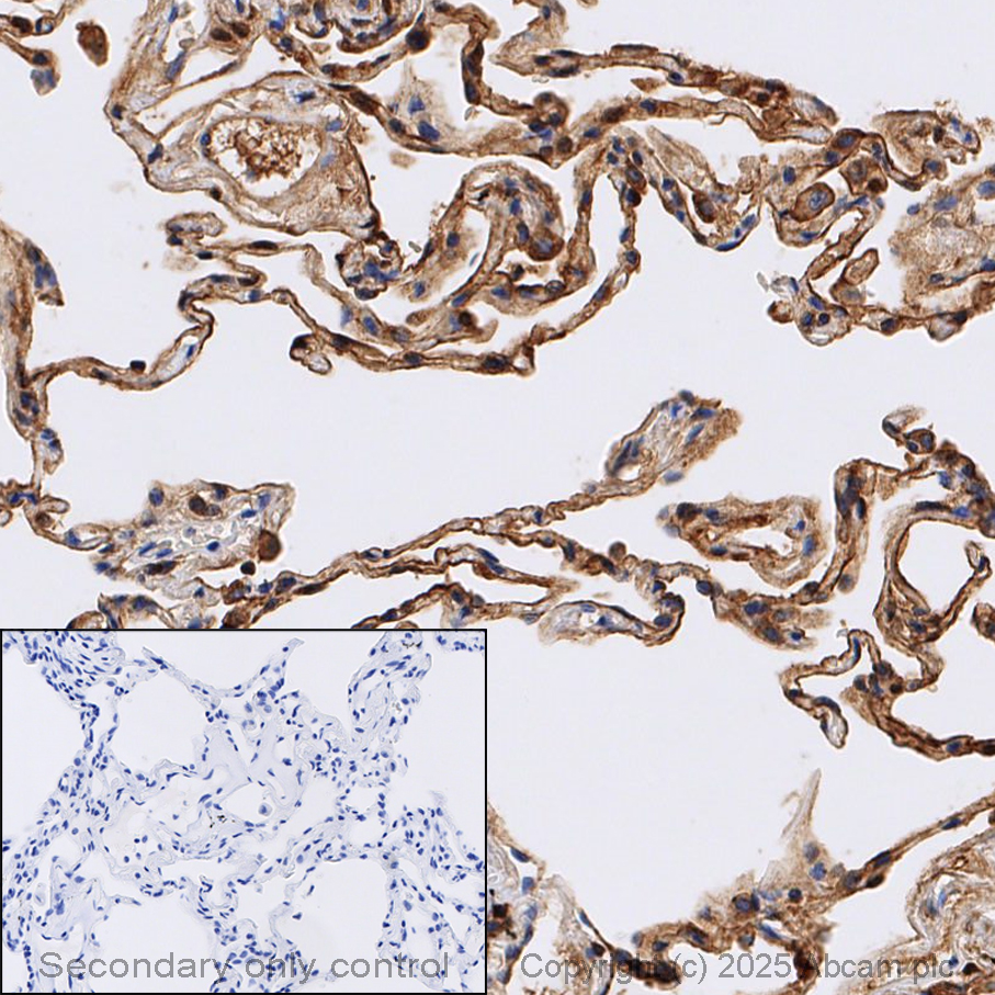 Immunohistochemistry (Formalin/PFA-fixed paraffin-embedded sections) - Anti-RAGE antibody [EPR21171] - BSA and Azide free (AB228861)