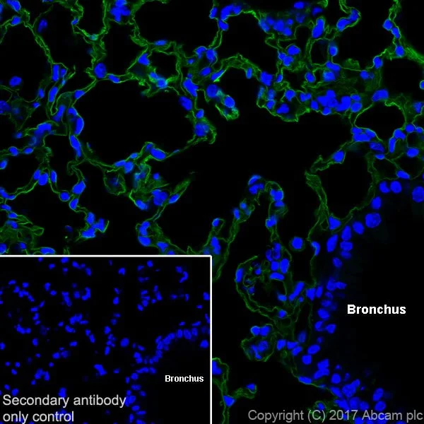 Immunohistochemistry (Frozen sections) - Anti-RAGE antibody [EPR21171] - BSA and Azide free (AB228861)