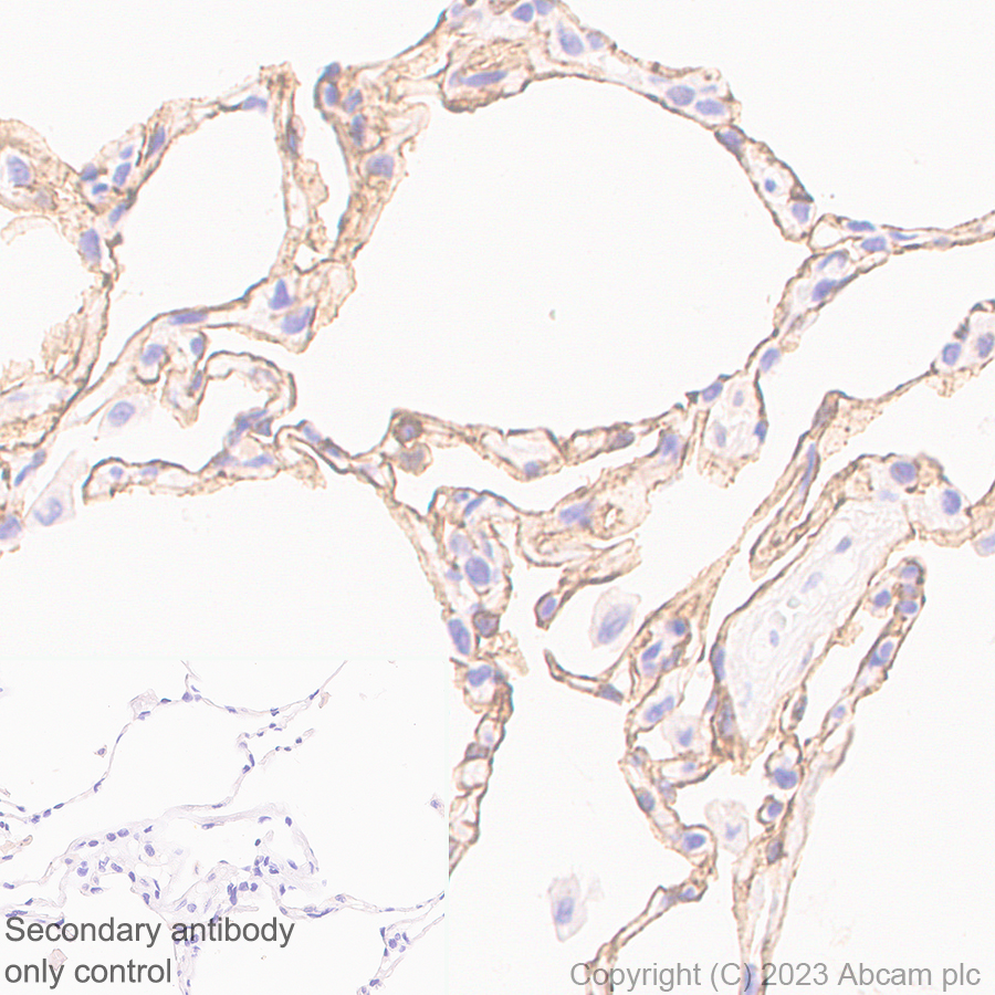 Immunohistochemistry (Formalin/PFA-fixed paraffin-embedded sections) - Anti-RAGE antibody [RM1078] (ab314773), expandable thumbnail