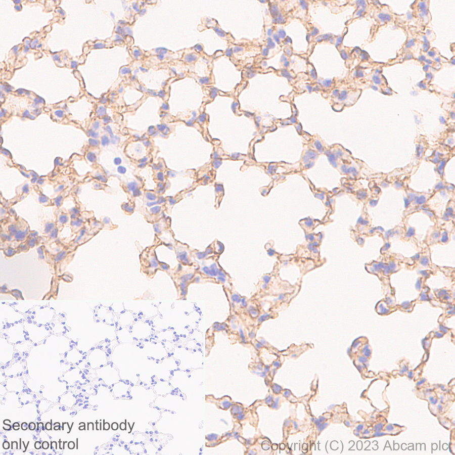 Immunohistochemistry (Formalin/PFA-fixed paraffin-embedded sections) - Anti-RAGE antibody [RM1078] (ab314773), expandable thumbnail
