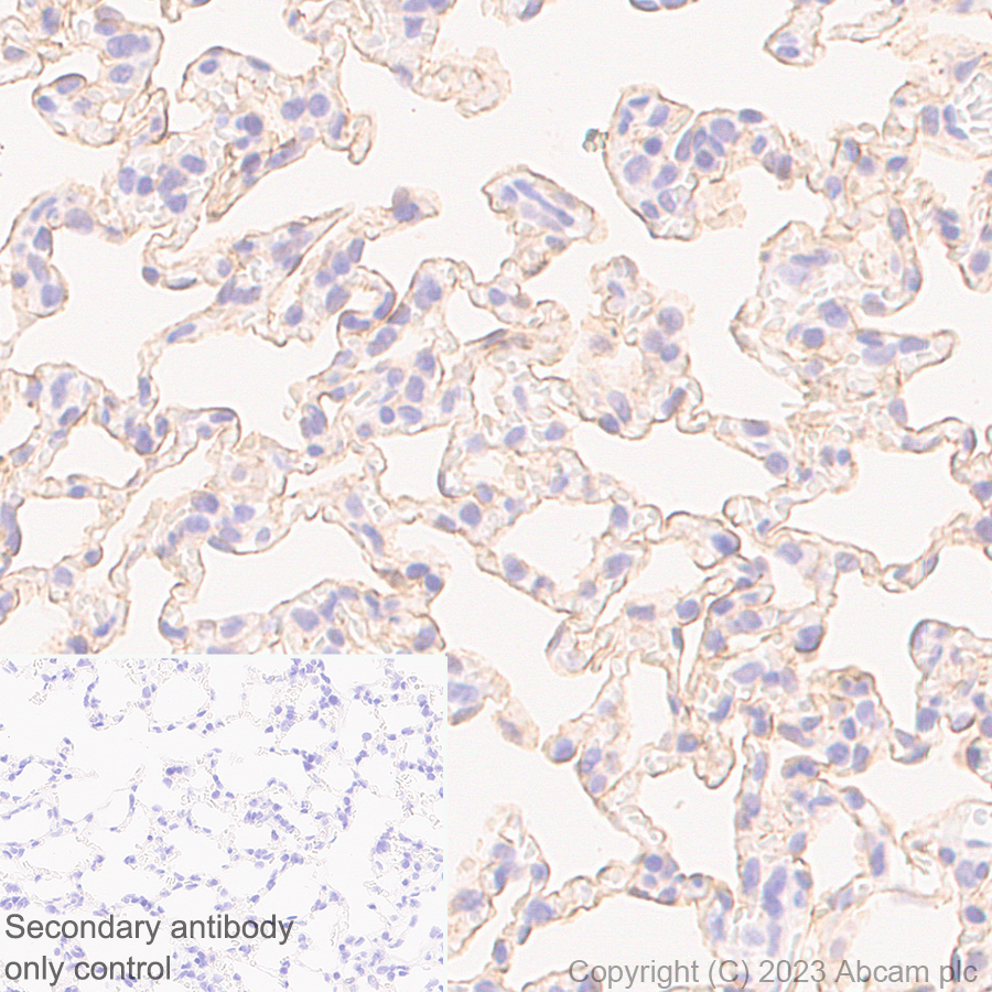 Immunohistochemistry (Formalin/PFA-fixed paraffin-embedded sections) - Anti-RAGE antibody [RM1078] (ab314773), expandable thumbnail