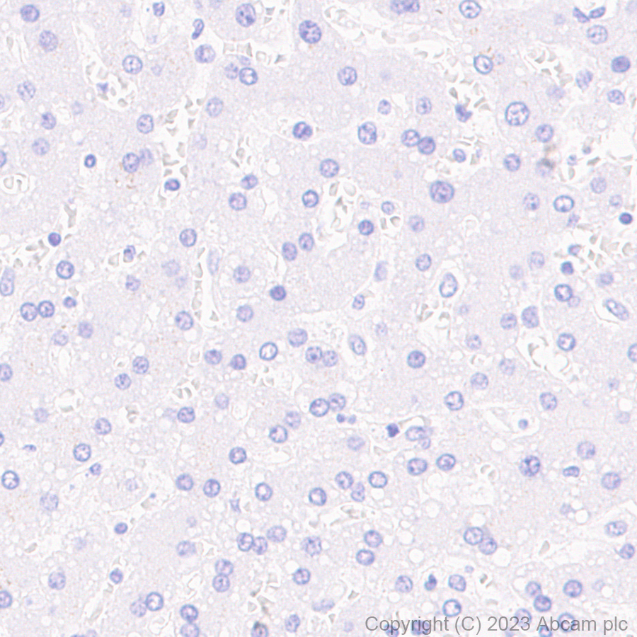 Immunohistochemistry (Formalin/PFA-fixed paraffin-embedded sections) - Anti-RAGE antibody [RM1078] (ab314773), expandable thumbnail