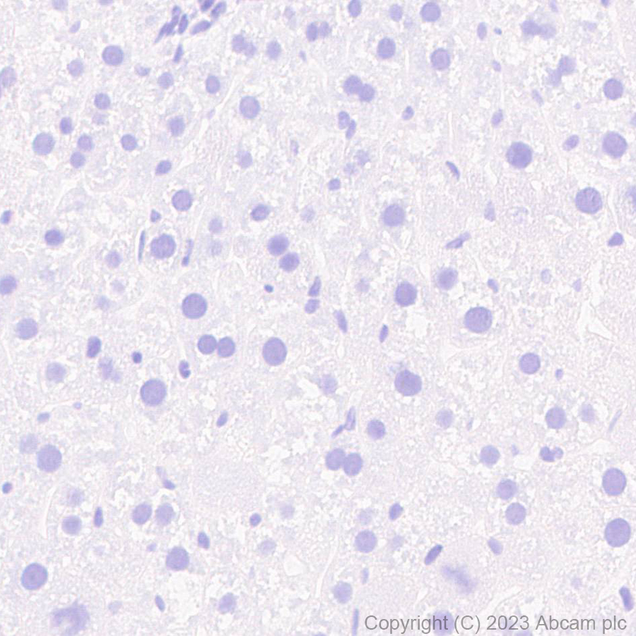 Immunohistochemistry (Formalin/PFA-fixed paraffin-embedded sections) - Anti-RAGE antibody [RM1078] (ab314773), expandable thumbnail
