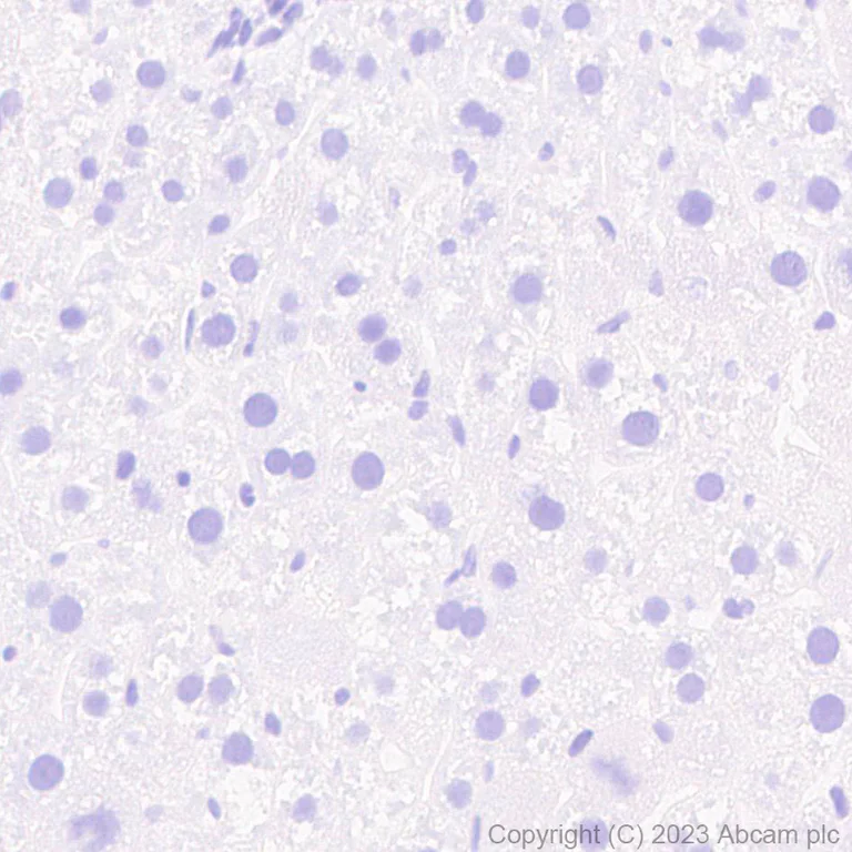 Immunohistochemistry (Formalin/PFA-fixed paraffin-embedded sections) - Anti-RAGE antibody [RM1078] (AB314773)