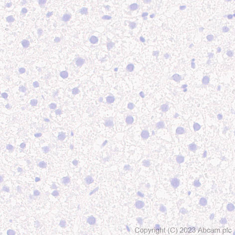 Immunohistochemistry (Formalin/PFA-fixed paraffin-embedded sections) - Anti-RAGE antibody [RM1078] (ab314773), expandable thumbnail