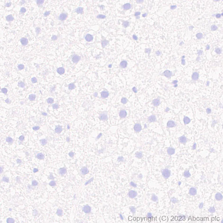 Immunohistochemistry (Formalin/PFA-fixed paraffin-embedded sections) - Anti-RAGE antibody [RM1078] (AB314773)