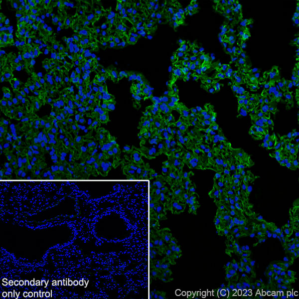Immunohistochemistry (Frozen sections) - Anti-RAGE antibody [RM1078] (ab314773), expandable thumbnail