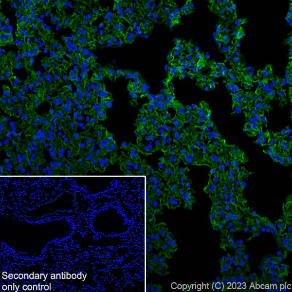 Immunohistochemistry (Frozen sections) - Anti-RAGE antibody [RM1078] (AB314773)