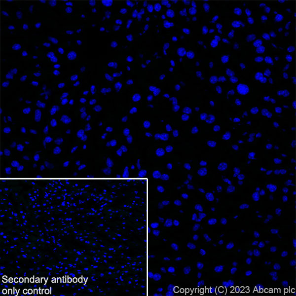 Immunohistochemistry (Frozen sections) - Anti-RAGE antibody [RM1078] (AB314773), expandable thumbnail