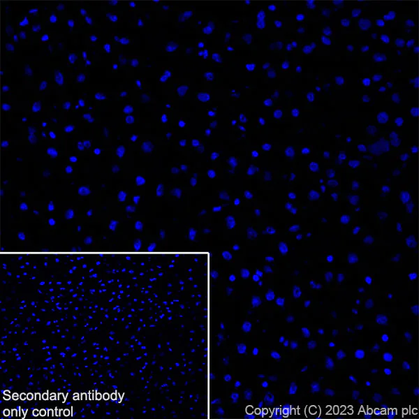 Immunohistochemistry (Frozen sections) - Anti-RAGE antibody [RM1078] (AB314773)