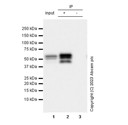 Immunoprecipitation - Anti-RAGE antibody [RM1078] (ab314773), expandable thumbnail