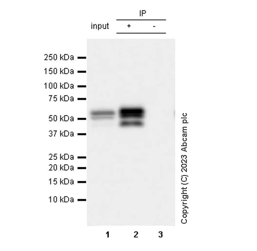 Immunoprecipitation - Anti-RAGE antibody [RM1078] (AB314773)
