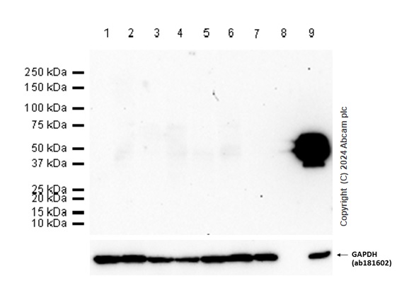 Western blot - Anti-RAGE antibody [RM1078] (AB314773), expandable thumbnail