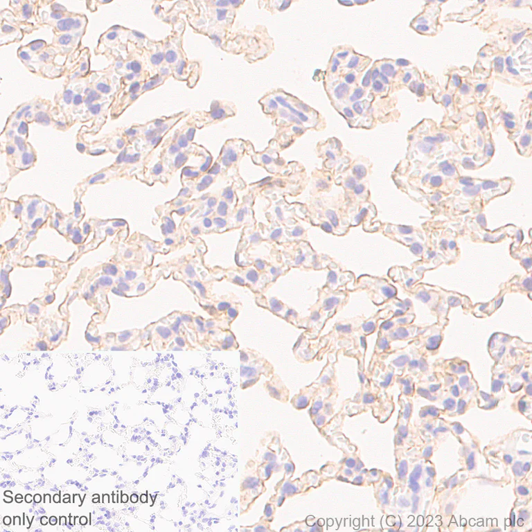 Immunohistochemistry (Formalin/PFA-fixed paraffin-embedded sections) - Anti-RAGE antibody [RM1078] - BSA and Azide free (AB314774)