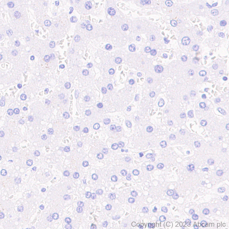 Immunohistochemistry (Formalin/PFA-fixed paraffin-embedded sections) - Anti-RAGE antibody [RM1078] - BSA and Azide free (AB314774)