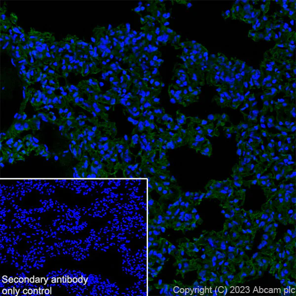 Immunohistochemistry (Frozen sections) - Anti-RAGE antibody [RM1078] - BSA and Azide free (AB314774)